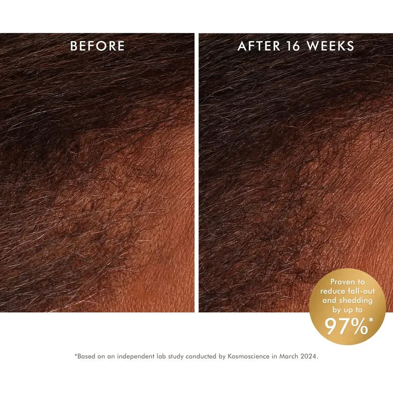 Tónico Revitalizante Para El Cuero Cabelludo Moroccanoil